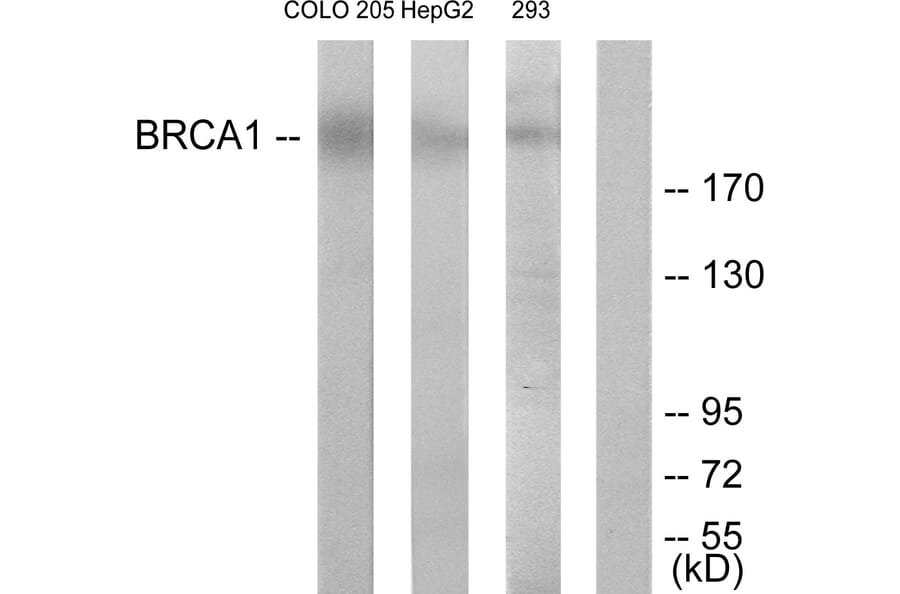 Western Blot - Anti-BRCA1 Antibody (B7031) - Antibodies.com