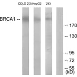 Western Blot - Anti-BRCA1 Antibody (B7031) - Antibodies.com