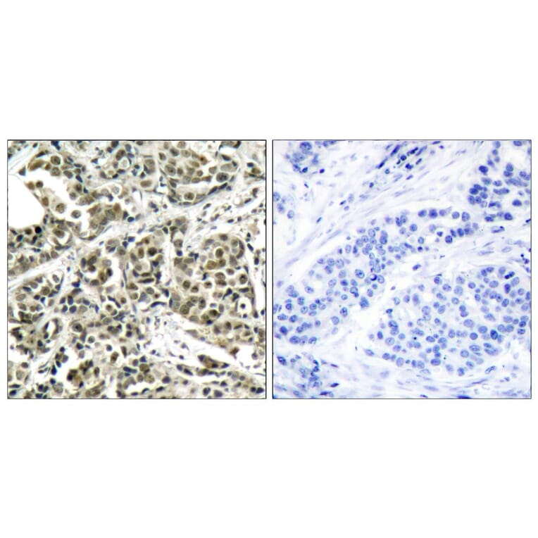 Immunohistochemistry - Anti-BRCA1 Antibody (B7031) - Antibodies.com