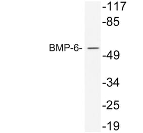 Western Blot - Anti-BMP-6 Antibody (R12-2038) - Antibodies.com