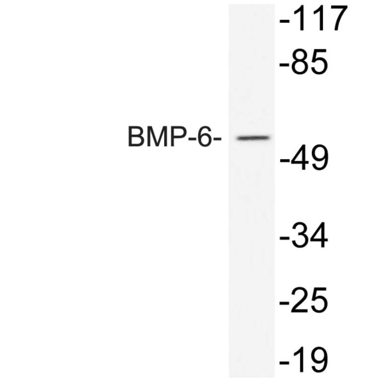 Western Blot - Anti-BMP-6 Antibody (R12-2038) - Antibodies.com