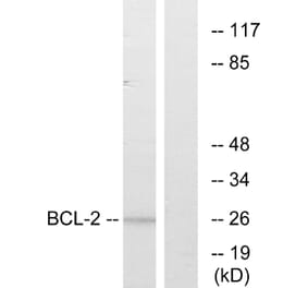 Western Blot - Anti-BCL-2 Antibody (B7026) - Antibodies.com