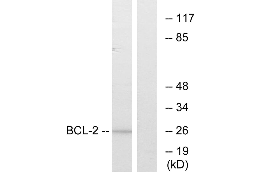 Western Blot - Anti-BCL-2 Antibody (B7026) - Antibodies.com
