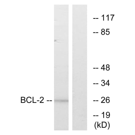 Western Blot - Anti-BCL-2 Antibody (B7026) - Antibodies.com