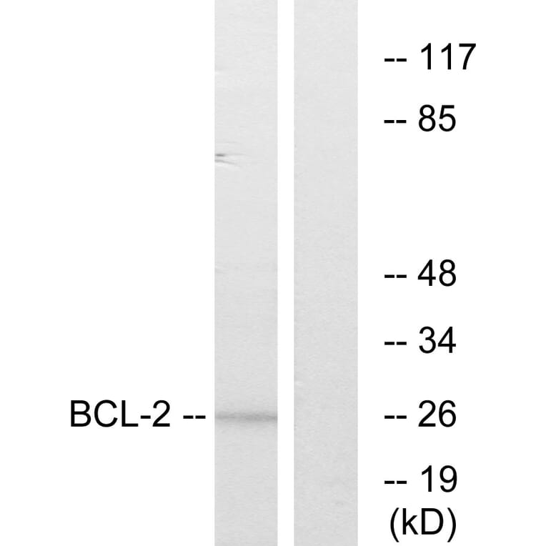 Western Blot - Anti-BCL-2 Antibody (B7026) - Antibodies.com