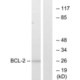 Western Blot - Anti-BCL-2 Antibody (B7026) - Antibodies.com