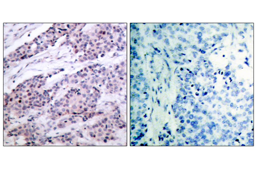 Immunohistochemistry - Anti-BCL-2 Antibody (B7026) - Antibodies.com