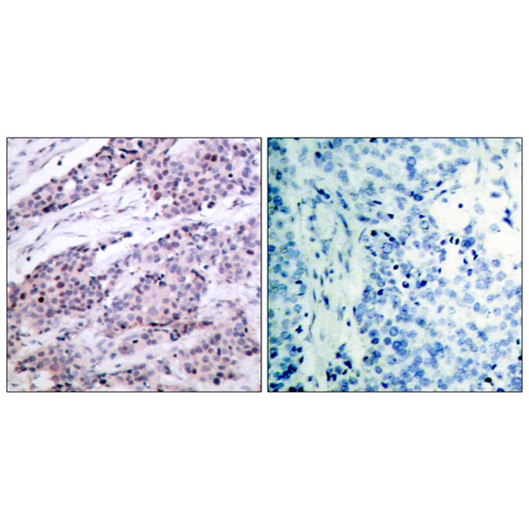 Immunohistochemistry - Anti-BCL-2 Antibody (B7026) - Antibodies.com