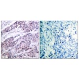 Immunohistochemistry - Anti-BCL-2 Antibody (B7026) - Antibodies.com