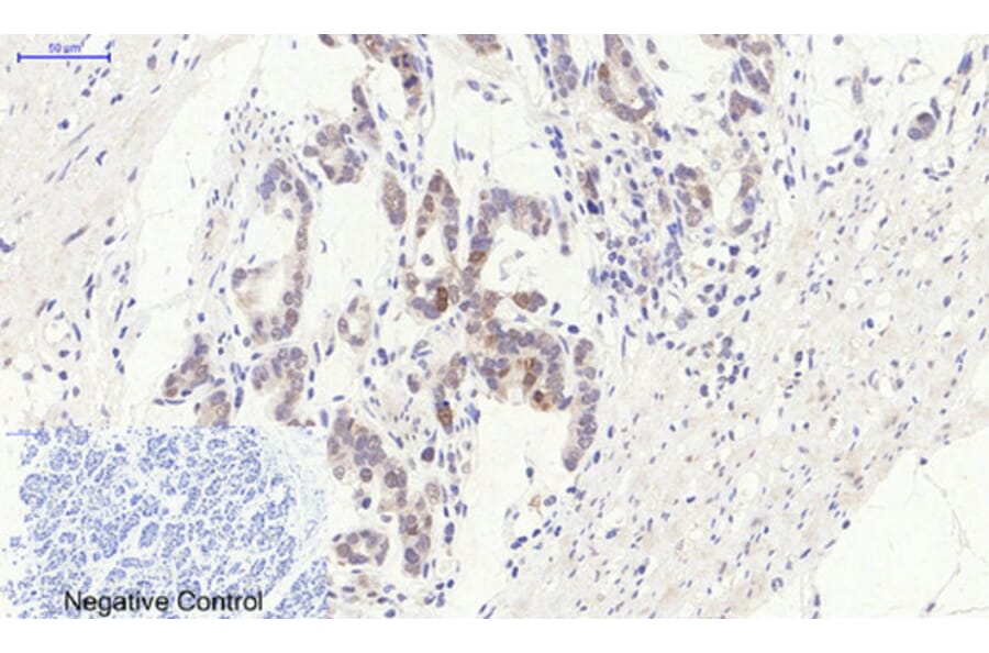 Immunohistochemistry - Anti-BCL-2 Antibody (B7026) - Antibodies.com