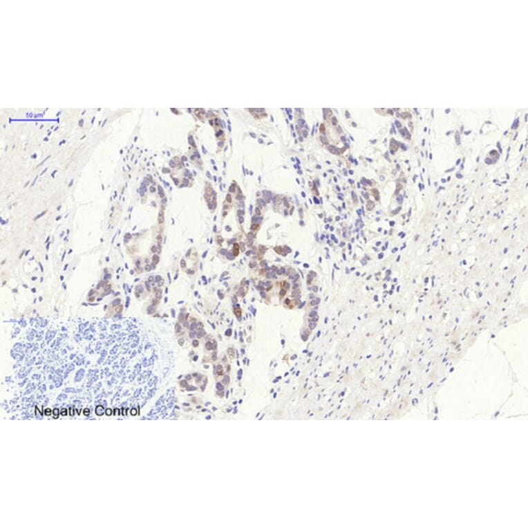 Immunohistochemistry - Anti-BCL-2 Antibody (B7026) - Antibodies.com