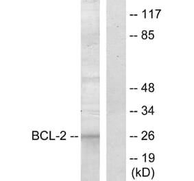 Western Blot - Anti-BCL-2 Antibody (B7025) - Antibodies.com