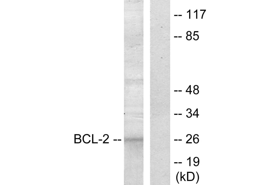 Western Blot - Anti-BCL-2 Antibody (B7025) - Antibodies.com