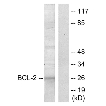 Western Blot - Anti-BCL-2 Antibody (B7025) - Antibodies.com