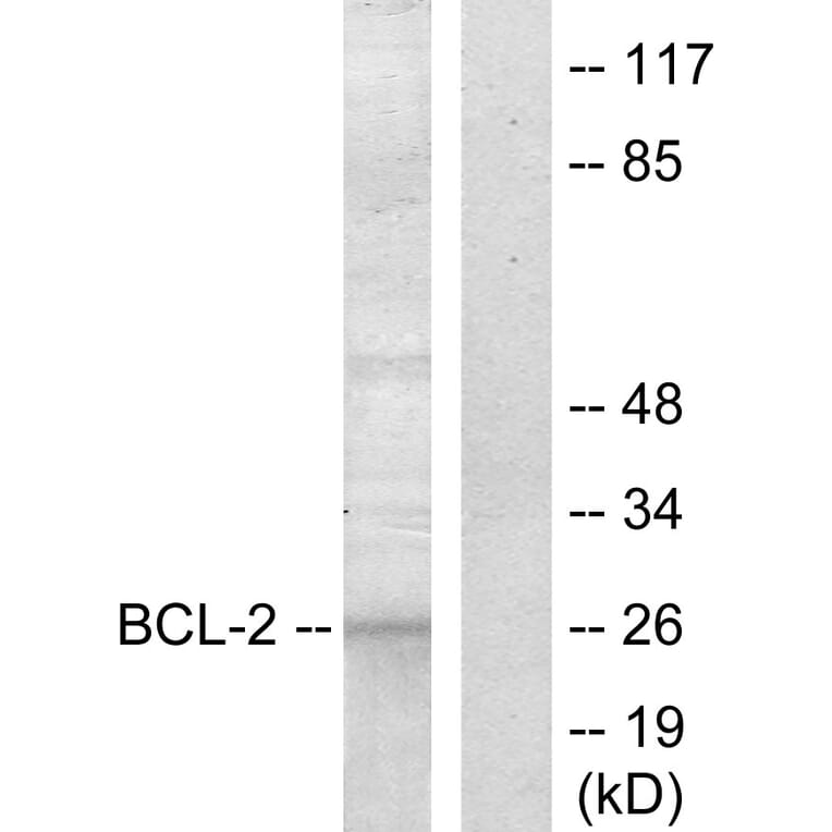 Western Blot - Anti-BCL-2 Antibody (B7025) - Antibodies.com