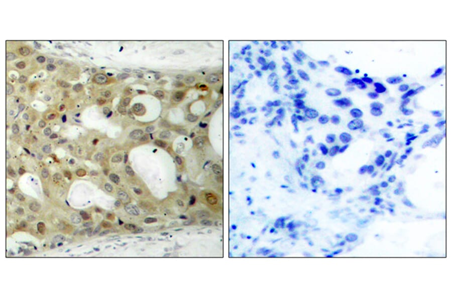 Immunohistochemistry - Anti-BCL-2 Antibody (B7025) - Antibodies.com