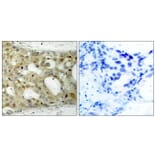 Immunohistochemistry - Anti-BCL-2 Antibody (B7025) - Antibodies.com