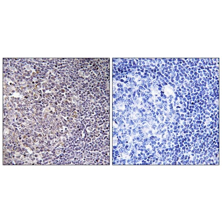 Immunohistochemistry - Anti-BCAS4 Antibody (C14803) - Antibodies.com