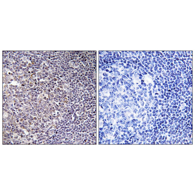 Immunohistochemistry - Anti-BCAS4 Antibody (C14803) - Antibodies.com