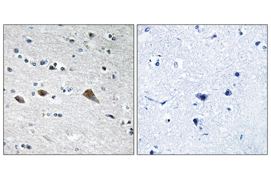 Immunohistochemistry - Anti-BCAR3 Antibody (C10193) - Antibodies.com