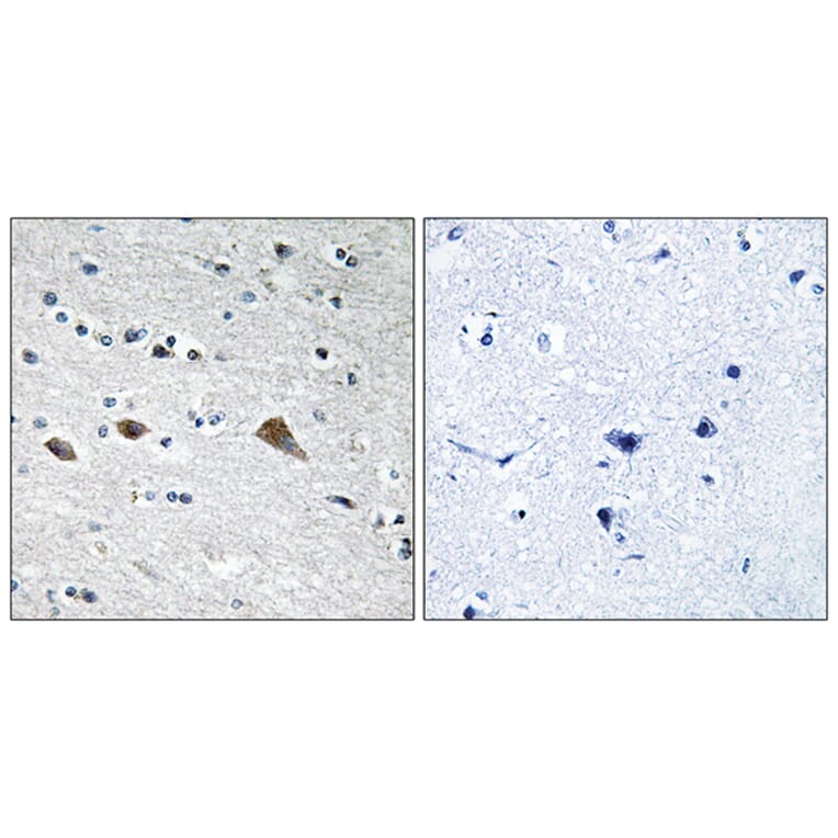 Immunohistochemistry - Anti-BCAR3 Antibody (C10193) - Antibodies.com