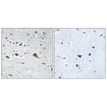 Immunohistochemistry - Anti-BCAR3 Antibody (C10193) - Antibodies.com