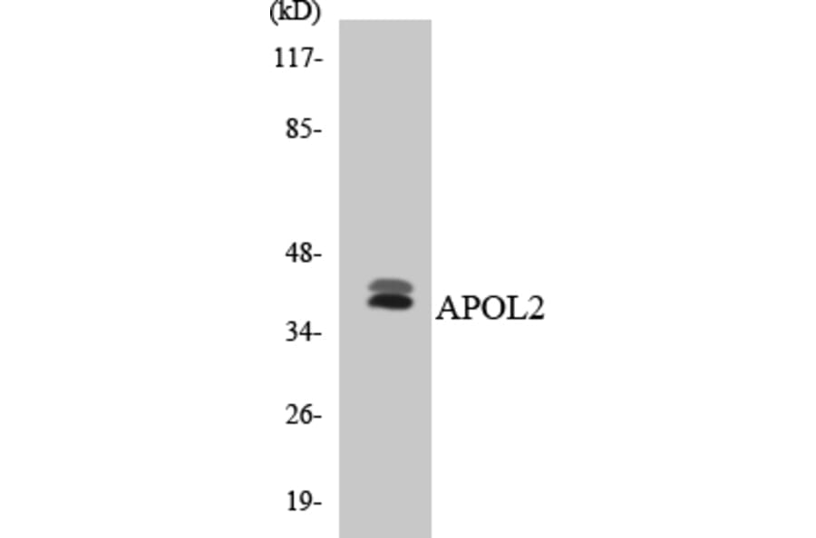 Western Blot - Anti-APOL2 Antibody (R12-2497) - Antibodies.com