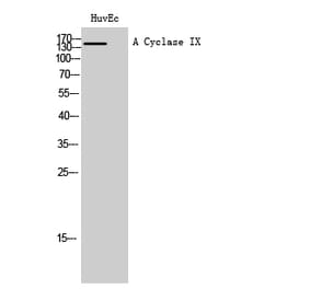 Western Blot - Anti-ADCY9 Antibody (C20506) - Antibodies.com