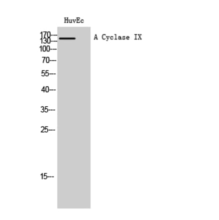 Western Blot - Anti-ADCY9 Antibody (C20506) - Antibodies.com