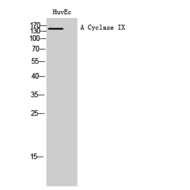 Western Blot - Anti-ADCY9 Antibody (C20506) - Antibodies.com