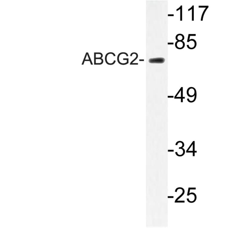 Western Blot - Anti-ABCG2 Antibody (R12-2001) - Antibodies.com