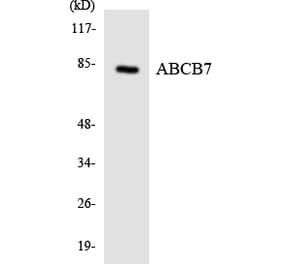 Western Blot - Anti-ABCB7 Antibody (R12-2425) - Antibodies.com