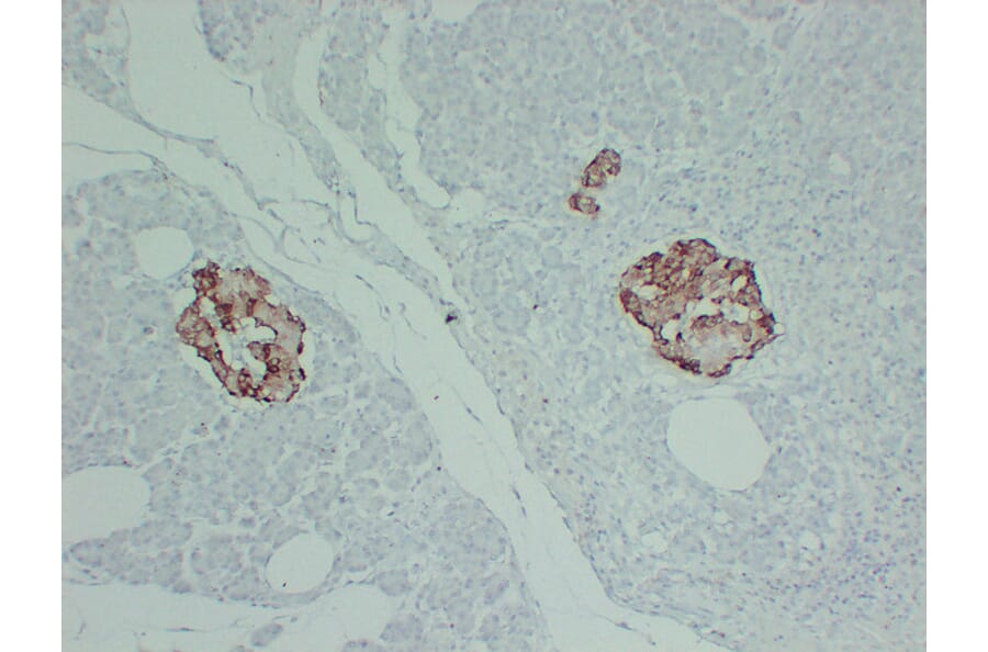 Immunohistochemistry - Anti-TIMP1 Antibody (V0148) - Antibodies.com