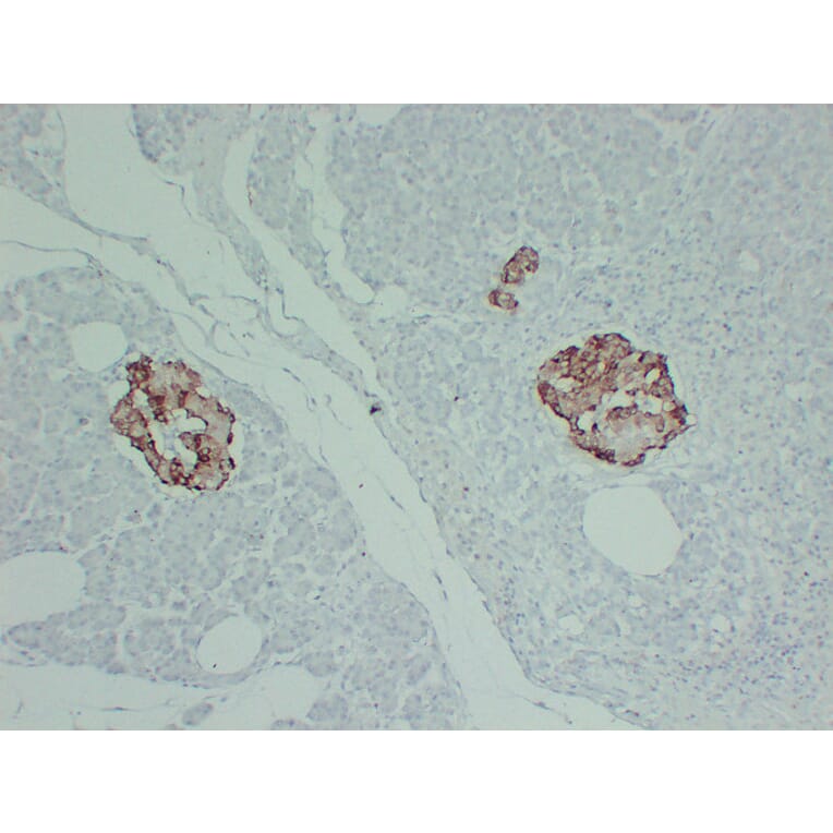 Immunohistochemistry - Anti-TIMP1 Antibody (V0148) - Antibodies.com