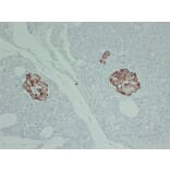 Immunohistochemistry - Anti-TIMP1 Antibody (V0148) - Antibodies.com
