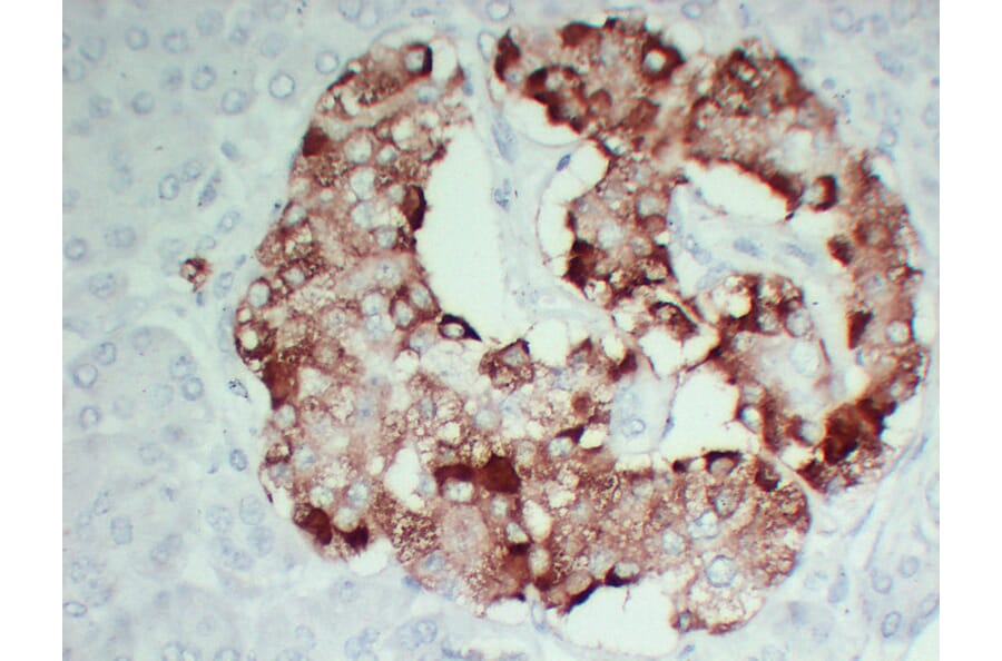Immunohistochemistry - Anti-TIMP1 Antibody (V0148) - Antibodies.com
