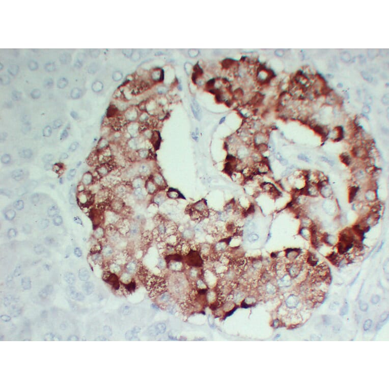 Immunohistochemistry - Anti-TIMP1 Antibody (V0148) - Antibodies.com