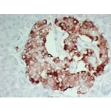 Immunohistochemistry - Anti-TIMP1 Antibody (V0148) - Antibodies.com