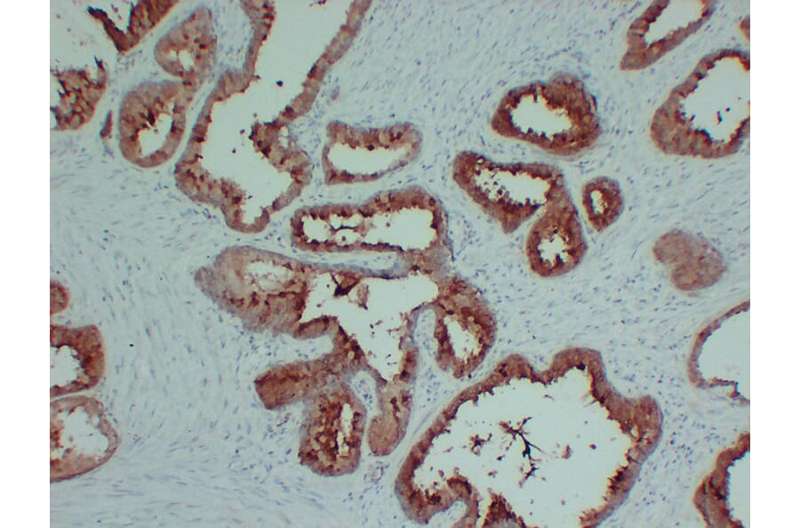 Immunohistochemistry - Anti-TIMP1 Antibody (V0148) - Antibodies.com