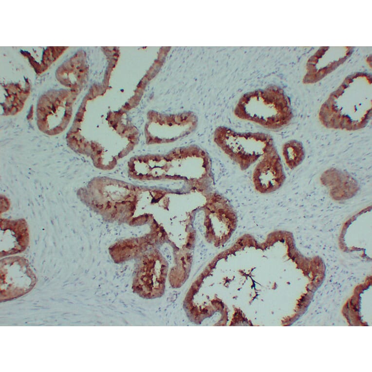 Immunohistochemistry - Anti-TIMP1 Antibody (V0148) - Antibodies.com