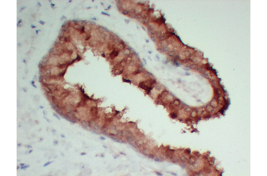 Immunohistochemistry - Anti-TIMP1 Antibody (V0148) - Antibodies.com