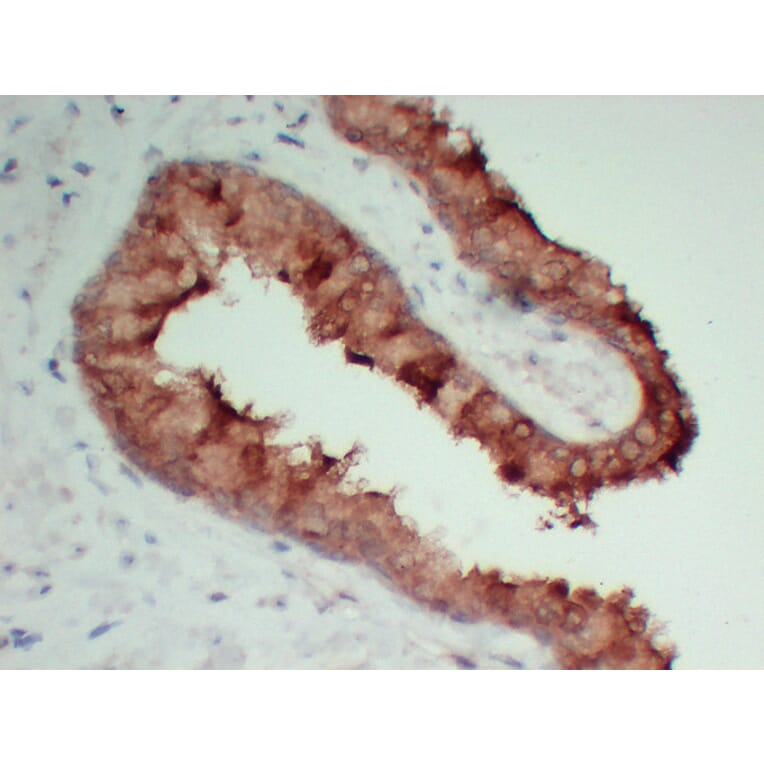 Immunohistochemistry - Anti-TIMP1 Antibody (V0148) - Antibodies.com