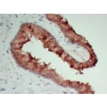 Immunohistochemistry - Anti-TIMP1 Antibody (V0148) - Antibodies.com