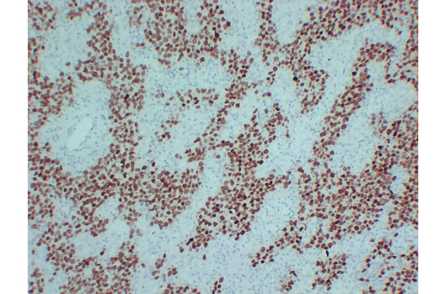 Immunohistochemistry - Anti-SALL4 Antibody (V0147) - Antibodies.com