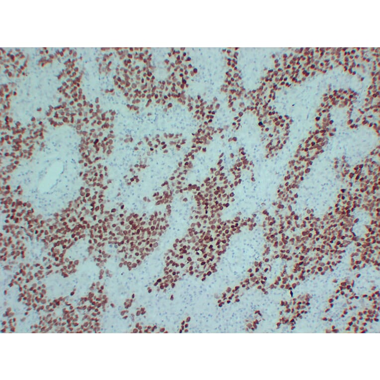 Immunohistochemistry - Anti-SALL4 Antibody (V0147) - Antibodies.com