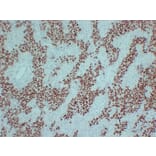 Immunohistochemistry - Anti-SALL4 Antibody (V0147) - Antibodies.com