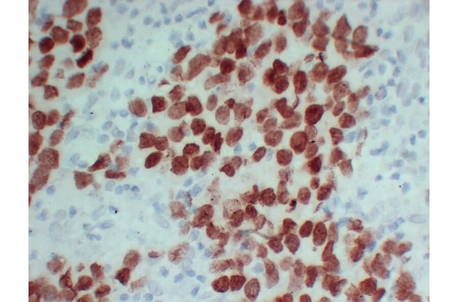 Immunohistochemistry - Anti-SALL4 Antibody (V0147) - Antibodies.com