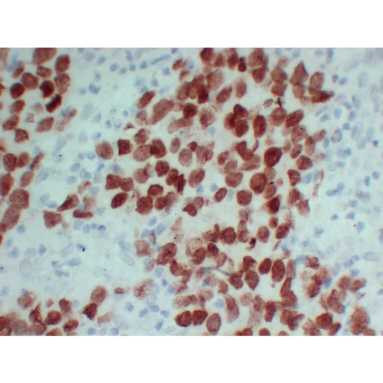 Immunohistochemistry - Anti-SALL4 Antibody (V0147) - Antibodies.com