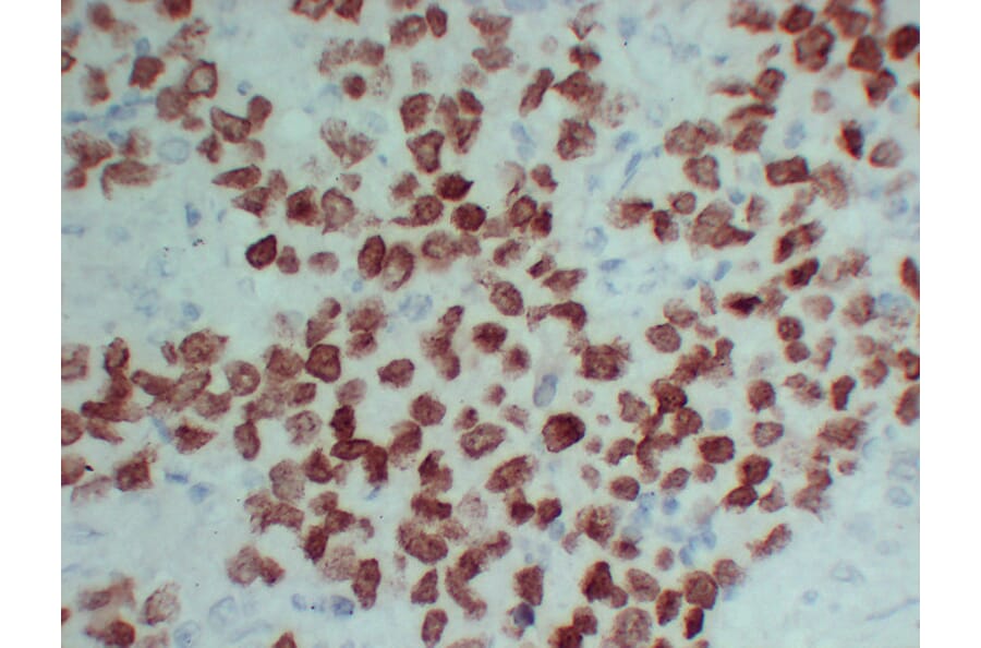 Immunohistochemistry - Anti-SALL4 Antibody (V0147) - Antibodies.com