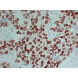 Immunohistochemistry - Anti-SALL4 Antibody (V0147) - Antibodies.com